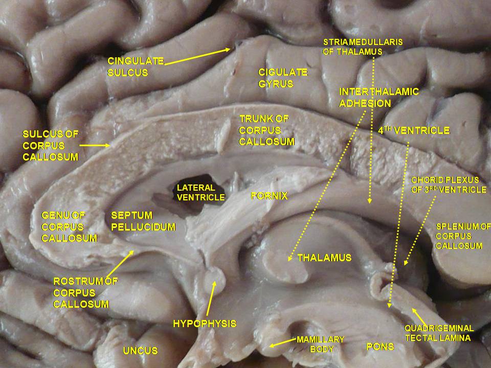 Gyrus cinguli der rechten Großhirnhälfte